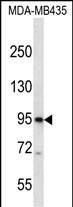 CNGB3 Antibody (N-term) (Cat. #AP50985PU-N) western blot analysis in MDA-MB435 cell line lysates (35ug/lane).This demonstrates the CNGB3 antibody detected the CNGB3 protein (arrow).