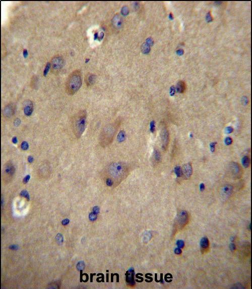 CNRP1 Antibody (Center) (Cat. #AP50991PU-N)immunohistochemistry analysis in formalin fixed and paraffin embedded human brain tissue followed by peroxidase conjugation of the secondary antibody and DAB staining.This data demonstrates the use of CNRP1 Antibody (Center) for immunohistochemistry.  Clinical relevance has not been evaluated.