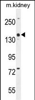 COBL Antibody (N-term) (Cat. #AP50999PU-N) western blot analysis in mouse kidney tissue lysates (35ug/lane).This demonstrates the COBL antibody detected the COBL protein (arrow).