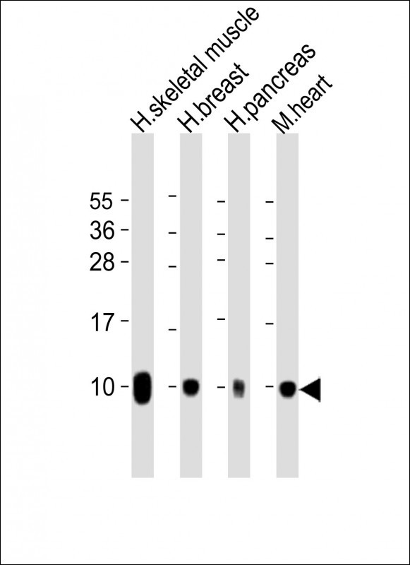All lanes : Anti-COX7A1 Antibody (Center) at 1:2000 dilution
Lane 1: human skeletal muscle lysate
Lane 2: human breast lysate
Lane 3: human pancreas lysate
Lane 4: mouse heart lysate

Lysates/proteins at 20 µg per lane. 

Secondary
Goat Anti-Rabbit IgG,  (H+L), Peroxidase conjugated at 1/10000 dilution. 

Predicted band size : 9 kDa

Blocking/Dilution buffer: 5% NFDM/TBST.