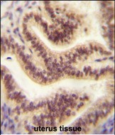 CP045 antibody (Center) (Cat. #AP10819c) immunohistochemistry analysis in formalin fixed and paraffin embedded human uterus tissue followed by peroxidase conjugation of the secondary antibody and DAB staining.  This data demonstrates the use of the CP045 antibody (Center) for immunohistochemistry.  Clinical relevance has not been evaluated.