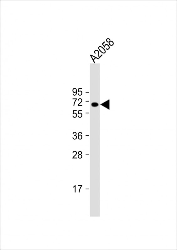 Anti-CPEB1 Antibody (C-term) at 1:1000 dilution + A2058 whole cell lysate

Lysates/proteins at 20 µg per lane. 

Secondary
Goat Anti-Rabbit IgG,  (H+L), Peroxidase conjugated at 1/10000 dilution. 

Predicted band size : 63 kDa

Blocking/Dilution buffer: 5% NFDM/TBST.
