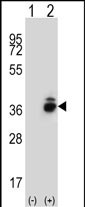 Western blot analysis of CRHBP (arrow) using rabbit polyclonal CRHBP Antibody (N-term) (Cat. #AP51082PU-N). 293 cell lysates (2 ug/lane) either nontransfected (Lane 1) or transiently transfected (Lane 2) with the CRHBP gene.