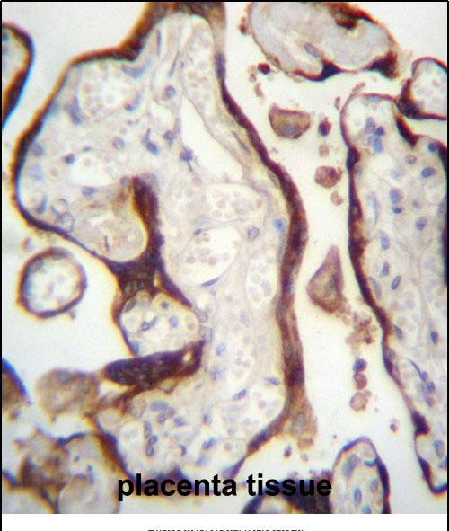 CSHL1 Antibody (C-term) (Cat. #AP13044a)immunohistochemistry analysis in formalin fixed and paraffin embedded human placenta tissue followed by peroxidase conjugation of the secondary antibody and DAB staining.This data demonstrates the use of CSHL1 Antibody (C-term) for immunohistochemistry.  Clinical relevance has not been evaluated.