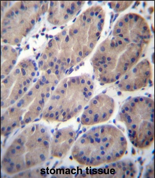 CTTNBP2NL Antibody (N-term) (Cat. #AP51136PU-N)immunohistochemistry analysis in formalin fixed and paraffin embedded human stomach tissue followed by peroxidase conjugation of the secondary antibody and DAB staining.This data demonstrates the use of CTTNBP2NL Antibody (N-term) for immunohistochemistry.  Clinical relevance has not been evaluated.