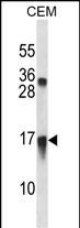 CXCL11 Antibody (C-term) (Cat. #AP51143PU-N) western blot analysis in CEM cell line lysates (35ug/lane).This demonstrates the CXCL11 antibody detected the CXCL11 protein (arrow).