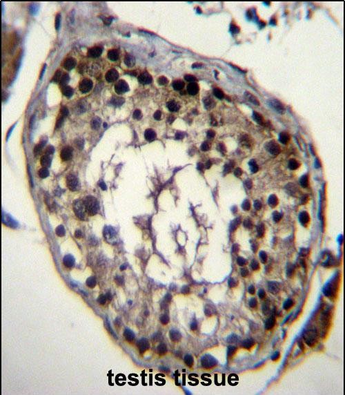 DAZ4 Antibody (Center) (Cat. #AP51188PU-N)immunohistochemistry analysis in formalin fixed and paraffin embedded human testis tissue followed by peroxidase conjugation of the secondary antibody and DAB staining.This data demonstrates the use of DAZ4 Antibody (Center) for immunohistochemistry.  Clinical relevance has not been evaluated.