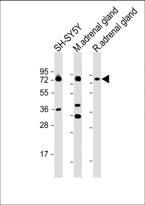 All lanes : Anti-DBH Antibody (N-term P42) at 1:2000 dilution
Lane 1: SH-SY5Y whole cell lysate
Lane 2: mouse adrenal gland lysate
Lane 3: rat adrenal gland lysate

Lysates/proteins at 20 µg per lane. 

Secondary
Goat Anti-Rabbit IgG,  (H+L), Peroxidase conjugated at 1/10000 dilution. 

Predicted band size : 69 kDa

Blocking/Dilution buffer: 5% NFDM/TBST.