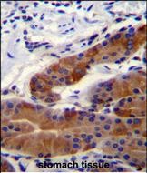 DFNB31 Antibody (Center) (Cat. #AP51246PU-N)immunohistochemistry analysis in formalin fixed and paraffin embedded stomach tissue followed by peroxidase conjugation of the secondary antibody and DAB staining.This data demonstrates the use of DFNB31 Antibody (Center) for immunohistochemistry.  Clinical relevance has not been evaluated.
