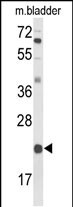 Western blot analysis of DGCR6 Antibody (Center) (Cat. #AP51250PU-N) in mouse bladder tissue lysates (35ug/lane). DGCR6 (arrow) was detected using the purified Pab.