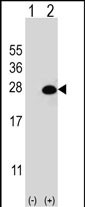 Western blot analysis of DGCR6L (arrow) using rabbit polyclonal DGCR6L Antibody (Center) (Cat. #AP12911c). 293 cell lysates (2 ug/lane) either nontransfected (Lane 1) or transiently transfected (Lane 2) with the DGCR6L gene.