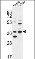 DHRS3 Antibody (Center) (Cat. #AP51254PU-N) western blot analysis in HepG2 cell line and mouse liver tissue lysates (35ug/lane).This demonstrates the DHRS3 antibody detected the DHRS3 protein (arrow).