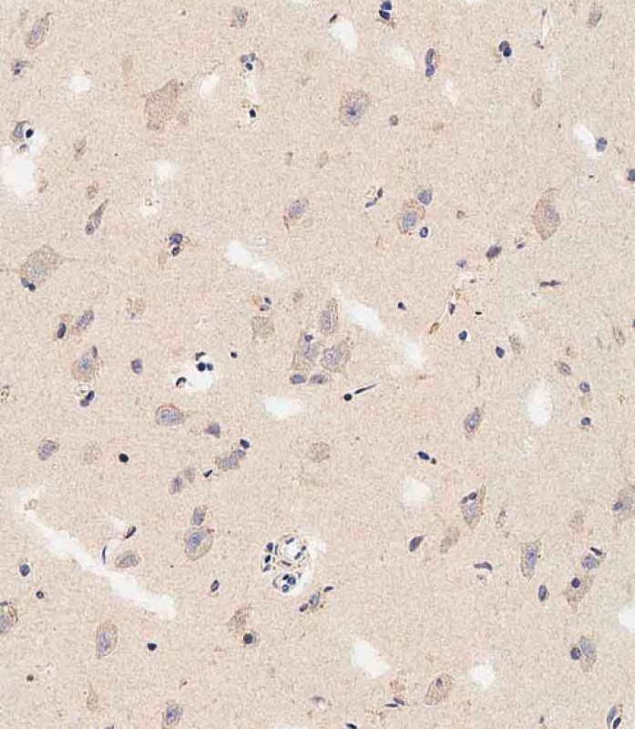 Immunohistochemical analysis of paraffin-embedded human brain tissue using AP9328B performed on the Leica® BOND RXm.  Tissue was fixed with formaldehyde at room temperature,   antigen retrieval was by heat mediation with a EDTA buffer (pH9.  0).  Samples were incubated with primary antibody(1:500) for 1 hours at room temperature.   A undiluted biotinylated CRF Anti-Polyvalent HRP Polymer antibody was used as the secondary antibody.
