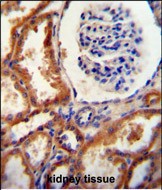 DNAJC22 antibody (C-term) (Cat. #AP10871b) immunohistochemistry analysis in formalin fixed and paraffin embedded human kidney tissue followed by peroxidase conjugation of the secondary antibody and DAB staining.  This data demonstrates the use of the DNAJC22 antibody (C-term) for immunohistochemistry.  Clinical relevance has not been evaluated.