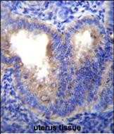 EIF5AL1 Antibody (C-term) (Cat. #AP51404PU-N)immunohistochemistry analysis in formalin fixed and paraffin embedded human uterus tissue followed by peroxidase conjugation of the secondary antibody and DAB staining.This data demonstrates the use of EIF5AL1 Antibody (C-term) for immunohistochemistry.  Clinical relevance has not been evaluated.