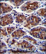 EPHX3 Antibody (C-term) (Cat. #AP51444PU-N)immunohistochemistry analysis in formalin fixed and paraffin embedded human stomach tissue followed by peroxidase conjugation of the secondary antibody and DAB staining.This data demonstrates the use of EPHX3 Antibody (C-term) for immunohistochemistry.  Clinical relevance has not been evaluated.