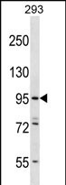 ESPNL Antibody (C-term) (Cat. #AP51463PU-N) western blot analysis in 293 cell line lysates (35ug/lane).This demonstrates the ESPNL antibody detected the ESPNL protein (arrow).