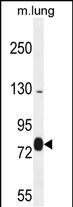 EXOC8 Antibody (Center) (Cat. #AP51481PU-N) western blot analysis in mouse lung tissue lysates (35ug/lane).This demonstrates the EXOC8 antibody detected the EXOC8 protein (arrow).