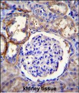 FA96A Antibody  (C-term) (Cat. #AP51504PU-N)immunohistochemistry analysis in formalin fixed and paraffin embedded human kidney tissue followed by peroxidase conjugation of the secondary antibody and DAB staining.This data demonstrates the use of FA96A Antibody  (C-term) for immunohistochemistry.  Clinical relevance has not been evaluated.