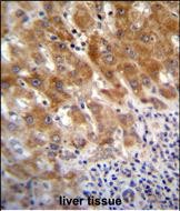 FAH Antibody (N-term) (Cat. #AP51509PU-N)immunohistochemistry analysis in formalin fixed and paraffin embedded human liver tissue followed by peroxidase conjugation of the secondary antibody and DAB staining.This data demonstrates the use of FAH Antibody (N-term) for immunohistochemistry.  Clinical relevance has not been evaluated.