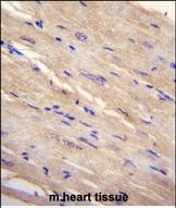 FAM69B Antibody (N-term) (Cat. #AP51588PU-N)immunohistochemistry analysis in formalin fixed and paraffin embedded human m.heart tissue followed by peroxidase conjugation of the secondary antibody and DAB staining.This data demonstrates the use of FAM69B Antibody (N-term) for immunohistochemistry.  Clinical relevance has not been evaluated.
