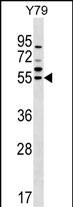 FDXR Antibody (C-term) (Cat. #AP51647PU-N) western blot analysis in Y79 cell line lysates (35ug/lane).This demonstrates the FDXR antibody detected the FDXR protein (arrow).