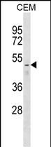 FNTB Antibody (N-term) (Cat. #AP51695PU-N) western blot analysis in CEM cell line lysates (35ug/lane).This demonstrates the FNTB antibody detected the FNTB protein (arrow).