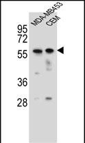 FOXD4 Antibody (Center) (Cat. #AP51705PU-N) western blot analysis in MDA-MB453,CEM cell line lysates (35ug/lane).This demonstrates the FOXD4 antibody detected the FOXD4 protein (arrow).
