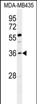 FOXE3 Antibody (Center) (Cat. #AP51707PU-N) western blot analysis in MDA-MB435 cell line lysates (35ug/lane).This demonstrates the FOXE3 antibody detected the FOXE3 protein (arrow).
