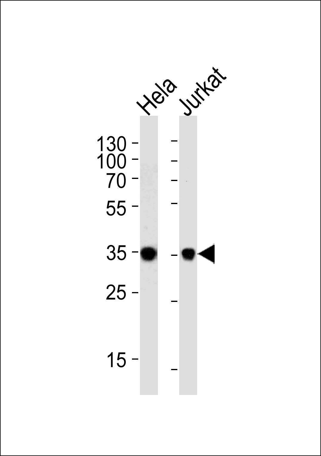 Western blot analysis of lysates from Hela, Jurkat cell line (from left to right), using FRG1 Antibody (C-term)(Cat. #AP51724PU-N). AP51724PU-N was diluted at 1:1000 at each lane. A goat anti-rabbit IgG H&L(HRP) at 1:5000 dilution was used as the secondary antibody. Lysates at 35ug per lane.