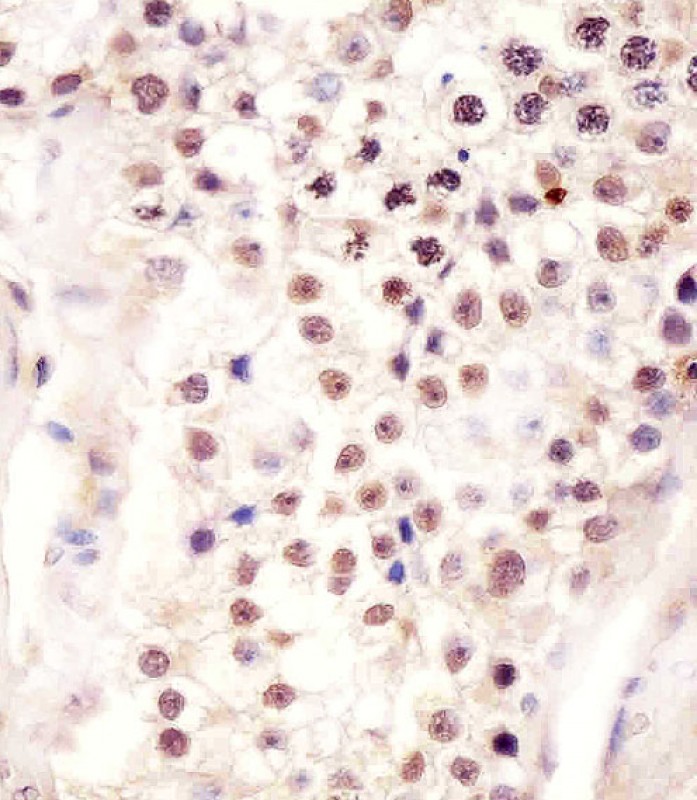AP12300B staining FSTL3 in human testis tissue sections by Immunohistochemistry (IHC-P - paraformaldehyde-fixed,  paraffin-embedded sections).  Tissue was fixed with formaldehyde and blocked with 3% BSA for 0. 5 hour at room temperature; antigen retrieval was by heat mediation with a citrate buffer (pH6).  Samples were incubated with primary antibody (1/25) for 1 hours at 37°C.  A undiluted biotinylated goat polyvalent antibody was used as the secondary antibody.