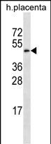 GAL3ST4 Antibody (Center) (Cat. #AP51762PU-N) western blot analysis in human placenta tissue lysates (35ug/lane).This demonstrates the GAL3ST4 antibody detected the GAL3ST4 protein (arrow).