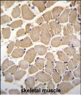 GAS2L2 Antibody (C-term) (Cat. #AP51783PU-N)immunohistochemistry analysis in formalin fixed and paraffin embedded human skeletal muscle followed by peroxidase conjugation of the secondary antibody and DAB staining.This data demonstrates the use of GAS2L2 Antibody (C-term) for immunohistochemistry.  Clinical relevance has not been evaluated.