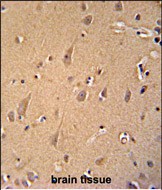 GCC2 antibody (C-term) (Cat. #AP51797PU-N) immunohistochemistry analysis in formalin fixed and paraffin embedded human brain tissue followed by peroxidase conjugation of the secondary antibody and DAB staining.  This data demonstrates the use of the GCC2 antibody (C-term) for immunohistochemistry.  Clinical relevance has not been evaluated.