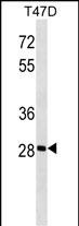 GK5 Antibody (N-term) (Cat. #AP51845PU-N) western blot analysis in T47D cell line lysates (35ug/lane).This demonstrates the GK5 antibody detected the GK5 protein (arrow).