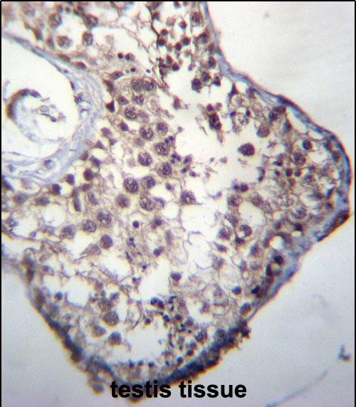 GLCCI1 Antibody (Center) (Cat. #AP51847PU-N)immunohistochemistry analysis in formalin fixed and paraffin embedded human testis tissue followed by peroxidase conjugation of the secondary antibody and DAB staining.This data demonstrates the use of GLCCI1 Antibody (Center) for immunohistochemistry.  Clinical relevance has not been evaluated.