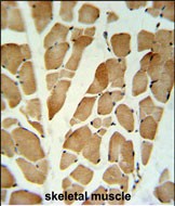 GLG1 Antibody (C-term) (Cat. #AP51850PU-N) IHC analysis in formalin fixed and paraffin embedded skeletal muscle followed by peroxidase conjugation of the secondary antibody and DAB staining.  This data demonstrates the use of the GLG1 Antibody (C-term) for immunohistochemistry.  Clinical relevance has not been evaluated.