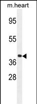 GNA15 Antibody (C-term) (Cat. #AP51872PU-N) western blot analysis in mouse heart tissue lysates (35ug/lane).This demonstrates the GNA15 antibody detected the GNA15 protein (arrow).