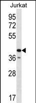 GORASP2 Antibody (Center) (Cat. #AP51894PU-N) western blot analysis in Jurkat cell line lysates (35ug/lane).This demonstrates the GORASP2 antibody detected the GORASP2 protein (arrow).