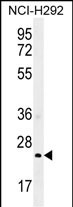 GSTA3 Antibody (N-term) (Cat. #AP51965PU-N) western blot analysis in NCI-H292 cell line lysates (35ug/lane).This demonstrates the GSTA3 antibody detected the GSTA3 protein (arrow).