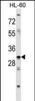 HOXB9 Antibody (Center) (Cat. #AP52081PU-N) western blot analysis in HL-60 cell line lysates (35ug/lane).This demonstrates the HOXB9 antibody detected the HOXB9 protein (arrow).