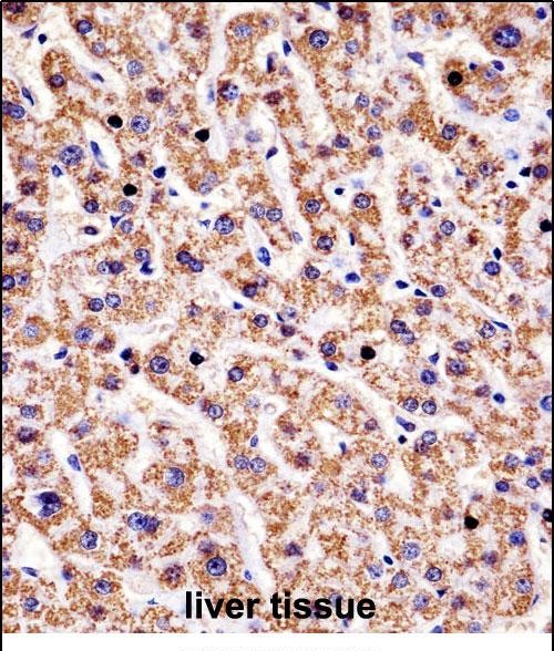 HYAL1 Antibody (C-term) (AP52132PU-N)immunohistochemistry analysis in formalin fixed and paraffin embedded human liver tissue followed by peroxidase conjugation of the secondary antibody and DAB staining.This data demonstrates the use of HYAL1 Antibody (C-term) for immunohistochemistry.  Clinical relevance has not been evaluated.