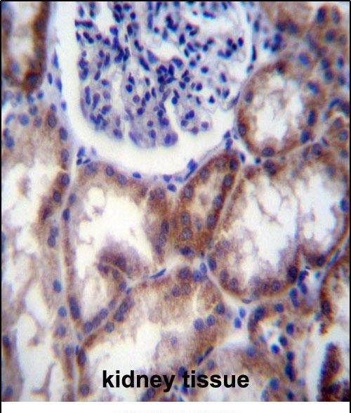 HYAL2 Antibody (Center) (Cat. #AP52133PU-N)immunohistochemistry analysis in formalin fixed and paraffin embedded human kidney tissue followed by peroxidase conjugation of the secondary antibody and DAB staining.This data demonstrates the use of HYAL2 Antibody (Center) for immunohistochemistry.  Clinical relevance has not been evaluated.