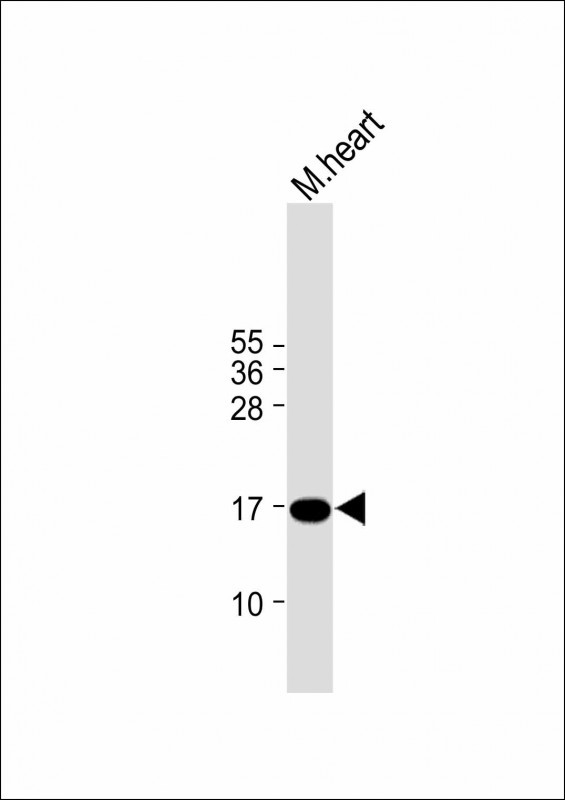 Anti-IER3 Antibody (N-term) at 1:1000 dilution + mouse heart lysate

Lysates/proteins at 20 µg per lane. 

Secondary
Goat Anti-Rabbit IgG,  (H+L), Peroxidase conjugated at 1/10000 dilution. 

Predicted band size : 17 kDa

Blocking/Dilution buffer: 5% NFDM/TBST.