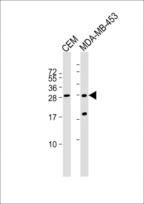 All lanes : Anti-IFI6 Antibody (N-term) at 1:1000 dilution
Lane 1: CEM whole cell lysate
Lane 2: MDA-MB-453 whole cell lysate

Lysates/proteins at 20 µg per lane. 

Secondary
Goat Anti-Rabbit IgG,  (H+L), Peroxidase conjugated at 1/10000 dilution. 

Predicted band size : 13 kDa

Blocking/Dilution buffer: 5% NFDM/TBST.