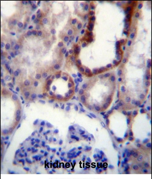 IGSF8 Antibody (Center) (Cat. #AP52177PU-N)immunohistochemistry analysis in formalin fixed and paraffin embedded human kidney tissue followed by peroxidase conjugation of the secondary antibody and DAB staining.This data demonstrates the use of IGSF8 Antibody (Center) for immunohistochemistry.  Clinical relevance has not been evaluated.