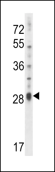 IL17D Antibody (C-term) (Cat. #AP14679b) western blot analysis in NCI-H460 cell line lysates (35ug/lane).This demonstrates the IL17D antibody detected the IL17D protein (arrow).