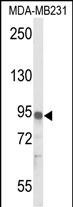 Western blot analysis of IL17RD Antibody (N-term) (Cat. #AP52189PU-N) in MDA-MB231 cell line lysates (35ug/lane). IL17RD (arrow) was detected using the purified Pab.
