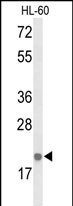 Western blot analysis of IL26 Antibody (Center) (Cat. #AP9472c) in HL-60 cell line lysates (35ug/lane). IL26 (arrow) was detected using the purified Pab.