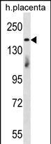 INTS1 Antibody (Cat. #AP12256a) western blot analysis in human placenta tissue lysates (35ug/lane).This demonstrates the INTS1 antibody detected the INTS1 protein (arrow).